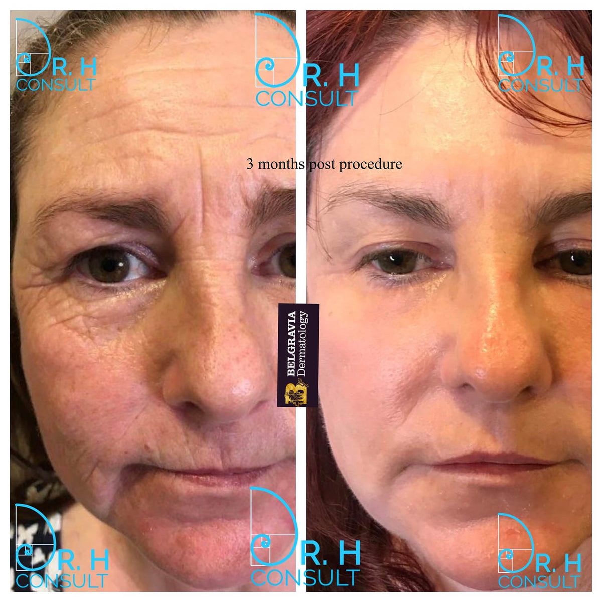 Core 2 Full Face
