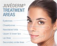 Juvederm Vollure