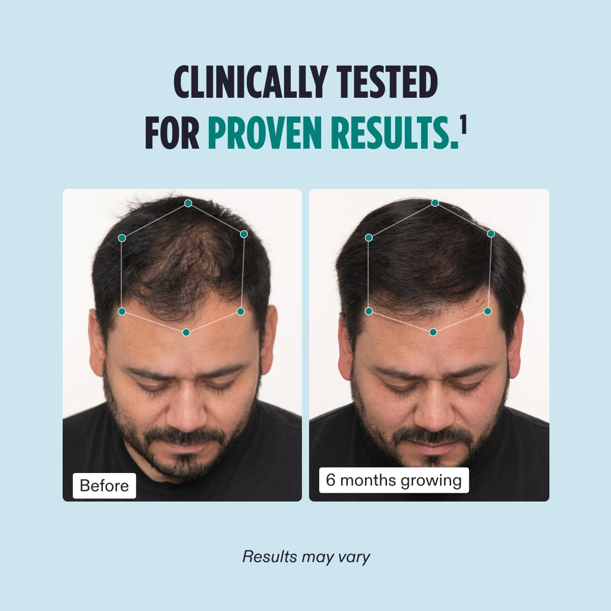 Nutrafol Men’s Hair Growth Supplements – Clinically Proven for Thicker, Stronger Hair  - NOT THE VEGAN VERSION-