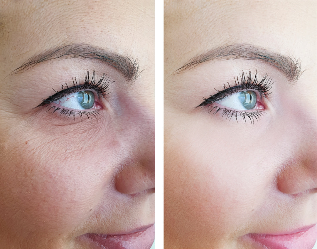 Core 2 Light Peel Series