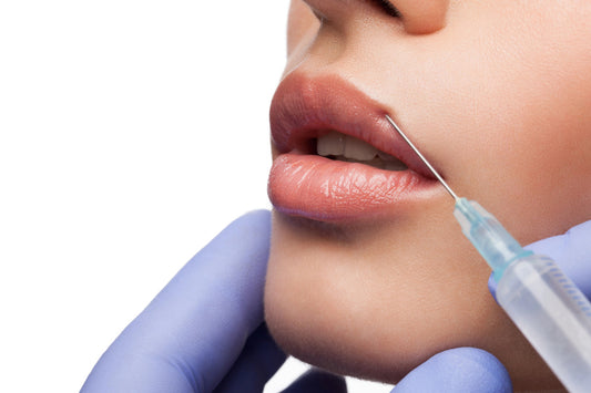 Lip Filler Revanesse Versa 1.2 cc