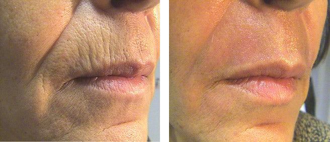 Core 2 Full Face